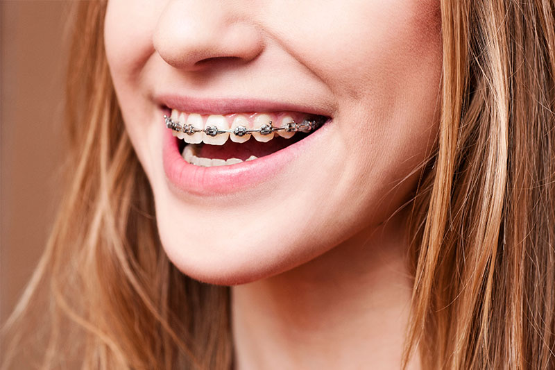 Orthodontics in Overland Park